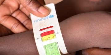 Kiryandongo Records Major Progress in Fight Against Child Malnutrition