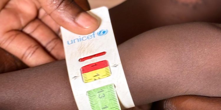 District leaders say continued support from development partners will be essential to maintain gains in child nutrition while addressing growing humanitarian and development needs in refugee-hosting communities.