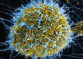Ebola Virus Disease Outbreak in Ituri Province, DRC: A Call for Urgent Regional Coordination Meeting 
