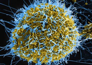 Ebola Virus Disease Outbreak in Ituri Province, DRC: A Call for Urgent Regional Coordination Meeting 