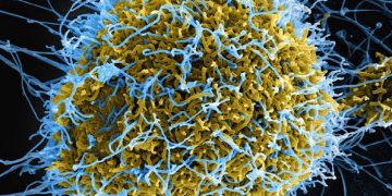 Ebola Virus Disease Outbreak in Ituri Province, DRC: A Call for Urgent Regional Coordination Meeting 