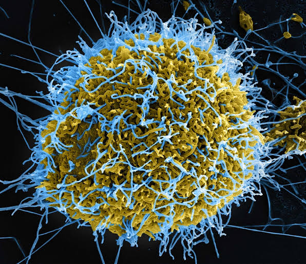 Ebola Virus Disease Outbreak in Ituri Province, DRC: A Call for Urgent Regional Coordination Meeting 