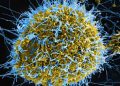 UK humanitarian worker monitored for Ebola after possible exposure in DR Congo