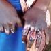 Schoolgirl’s hands burnt over alleged theft of shs1,000