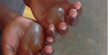 Mother sought after allegedly scalding boiling water on her four-year-old daughter